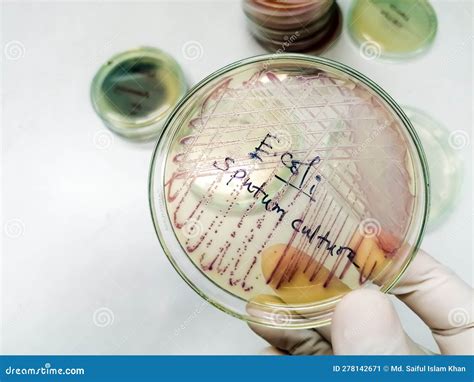 Sputum Culture Test Showing a Colony of E. Coli Bacterium Stock Image ...