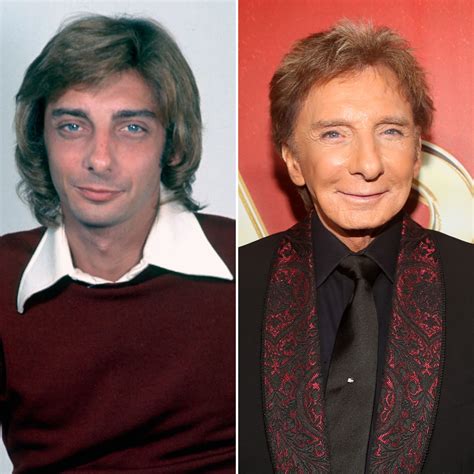 Did Barry Manilow Have Plastic Surgery Transformation Photos