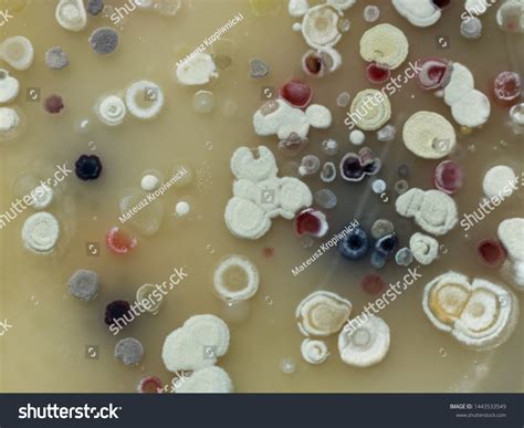 Growth Actinobacteria Cololonies On Cyganow Agar Stock Photo 1443533549 | Shutterstock