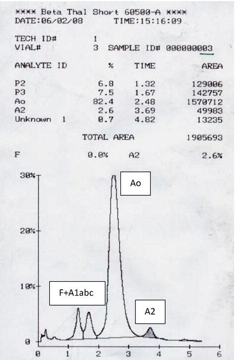 Laboratory Diagnosis Of β Thalassemia And Hbe Intechopen