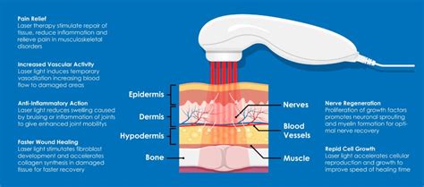 What Is Mls Laser Therapy How Does Mls Laser Therapy Work