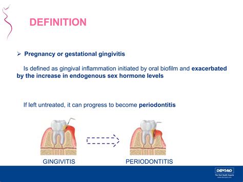 Periodontal Disease And Pregnancy Ppt