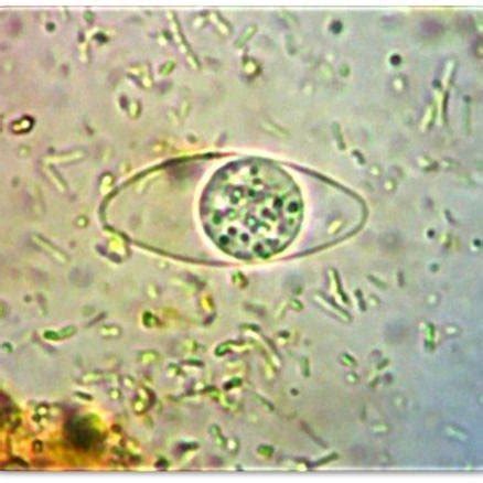 (PDF) Isospora belli: Un Coccidio importante de diagnosticar