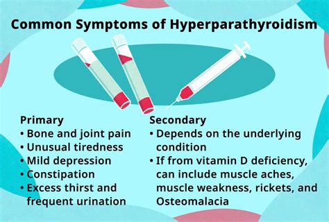 Secondary Hyperparathyroidism What Is It And How Is It 51 Off