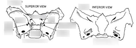 Superior View Of Sphenoid Bone Diagram Quizlet