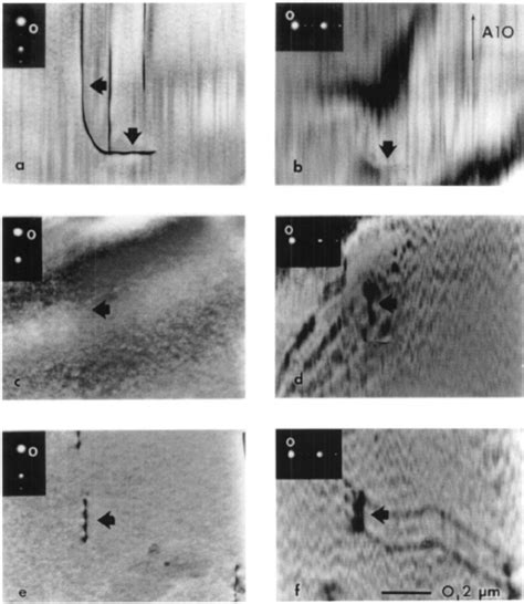 Bright Field Images Of Dislocations With A Burgers Vector Along The