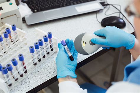 What Is Laboratory Sample Collection At Lonnie Mcghee Blog