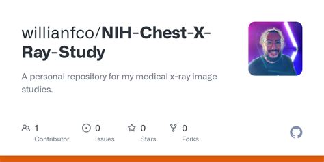 NIH Chest X Ray Study 02 Image Processing Ipynb At Master Willianfco