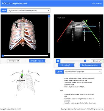 Lung Ultrasound Point Of Care Ultrasound Pocus Tte Pie Toronto