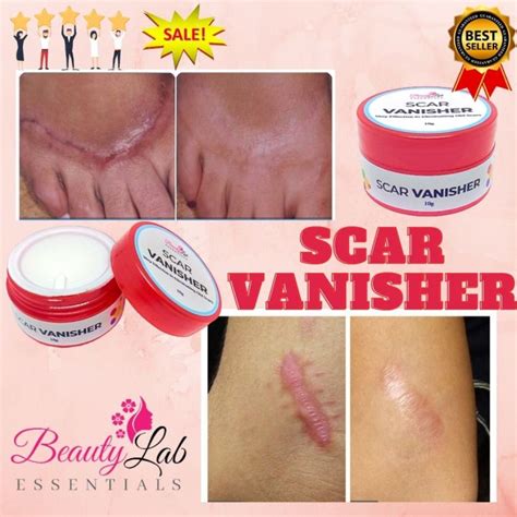 Scar Removal Cream Scar Remover For Old Scar On Leg Scar Remover Peklat