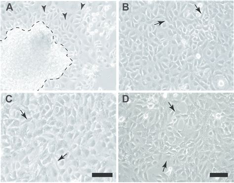 Generation Of Omentum Derived Adult Mouse Mesothelial Cell Lines A