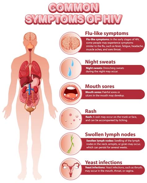 Free Vector Informative Poster Of Common Symptoms Of Hiv