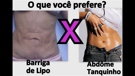 Papo Reto Barriga De Lipo X Abd Me Tanquinho Youtube