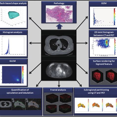 Radiomics Is Defined As The Processing Of Radiological Imaging Data Download Scientific Diagram