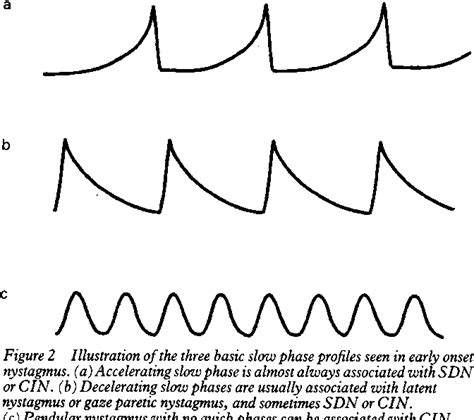 PDF Nystagmus In Infancy Semantic Scholar