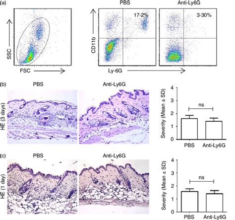 The Effect Of Neutrophil Depletion In The Development Of Skin