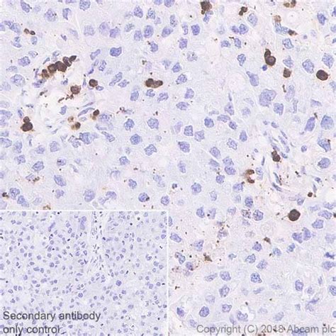 Macrophage Marker Cd11b Cd68 Cd163 Cd14 Cd16 Antibody Panel Human Ab254013