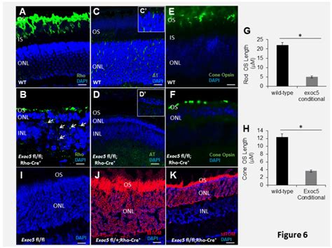 Immunohistochemical Analysis Of Rod And Cone Photoreceptors In