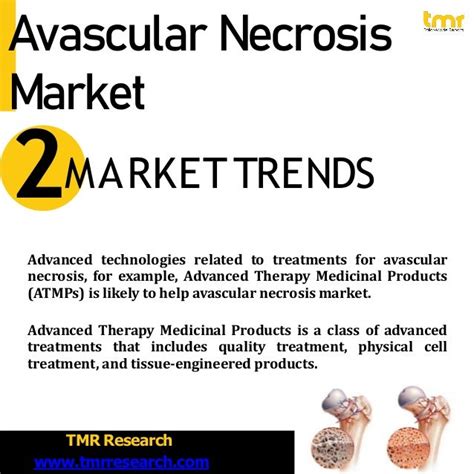 Avascular Necrosis - Symptoms and causes