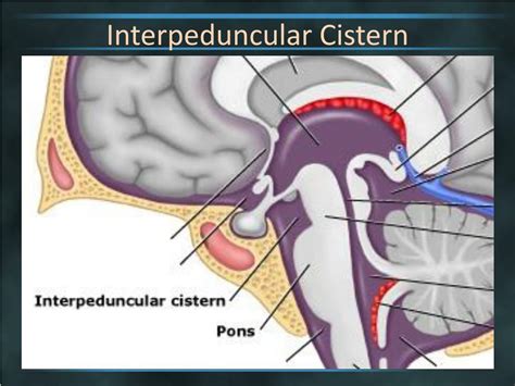 Ppt Brain Cisterns Powerpoint Presentation Free Download Id2263744