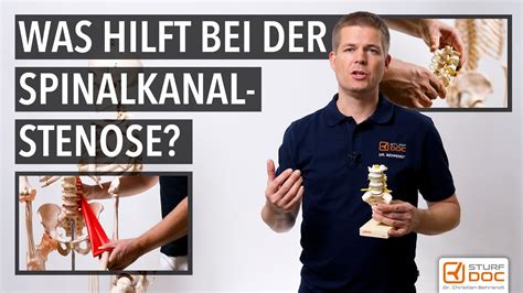 Spinalkanalstenose Teil 2 Das Hilft Reihenfolge Der