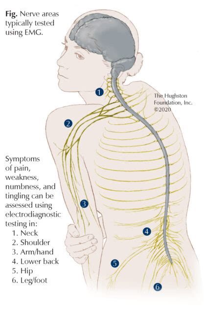 Emg Test Neck