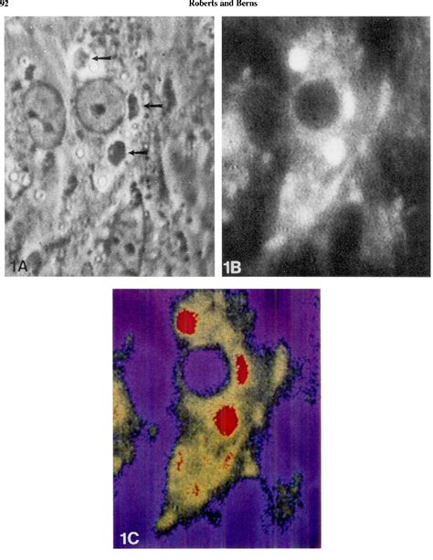 Figure 1 From In Vitro Photosensitization I Cellular Uptake And