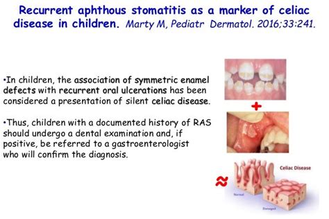 Recurrent aphthous stomatitis