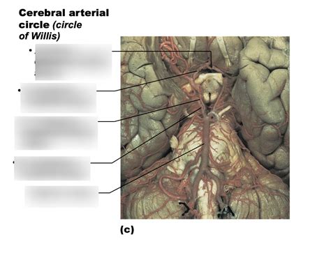 Cerebral Arterial Circle Circle Of Willis Diagram Quizlet