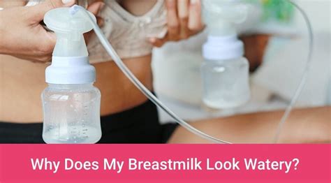 Why Does My Breastmilk Look Watery When To Be Concerned