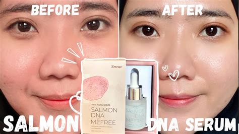 SALMON DNA ANTI AGING SERUM 20MEFREE SKIN MINIMALISM STEP BY STEP