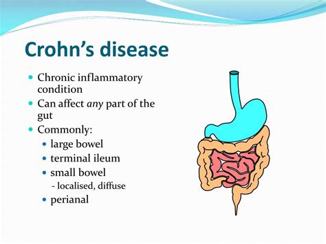 Ppt Crohn’s Disease Powerpoint Presentation Free Download Id 6614137