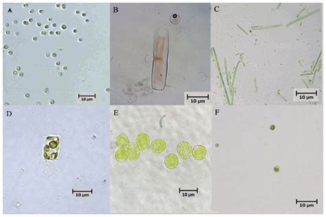 Marine Microalgae Co Cultured With Floc Forming Bacterium Insight Into