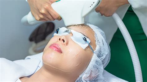 Ipl Skin Rejuvenation 9 Important Things You Need To Know If You Want To Transform Your Skin