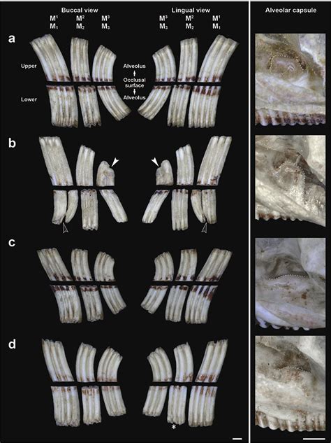 Typical Buccal And Lingual Views Of The Left Upper And Lower Molars And