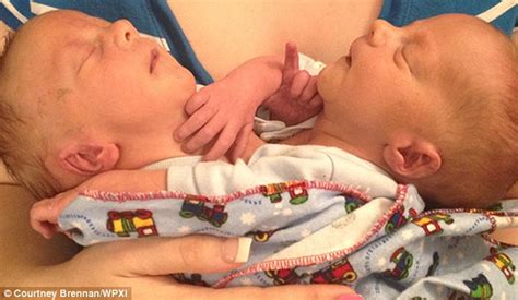 Mother Of Conjoined Twins Who Share A Heart Finally Welcomes Them Home