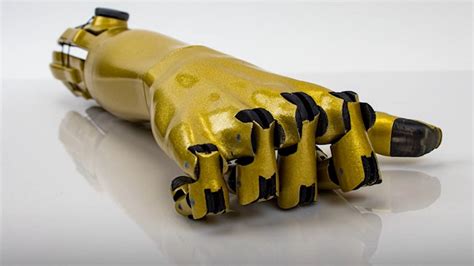 A Startup Is D Printing Bionic Arms For Ukrainians Injured In Conflict