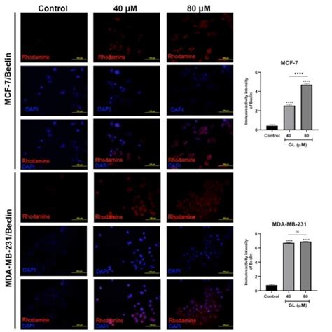 In The Mcf 7 And Mda Mb 231 Breast Cancer Cell Line Treated With Gl