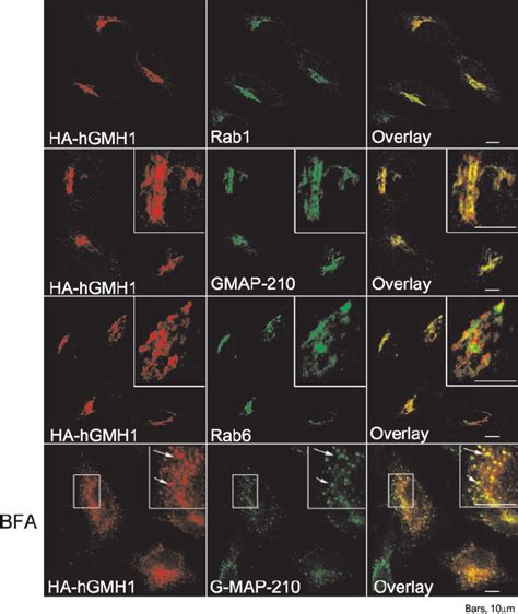 Immuno Fl Uorescence Localization Of Human Hgmh B In Hela Cells Hela