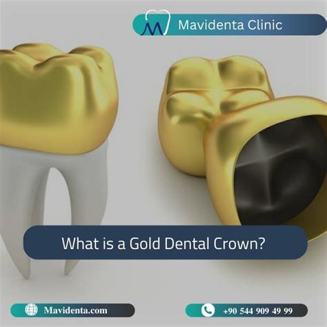 Zirconia Vs Gold Crown Which Is The Best For Your Teeth