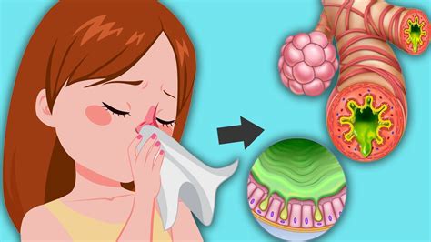 What Causes Excessive Phlegm In The Throat