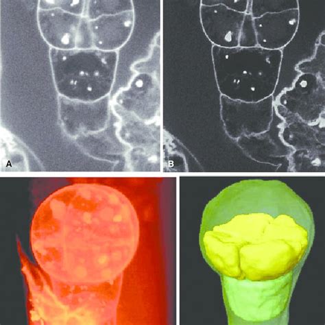 9 Three Dimensional Reconstruction Of Cell Arrangements Within An Download Scientific Diagram