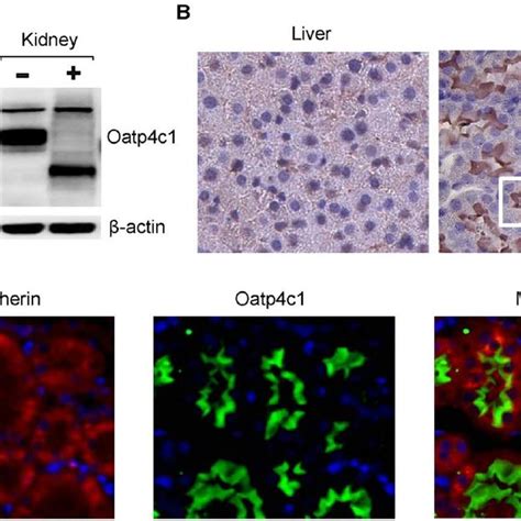 Oatp C Expression And Localization In Rat Kidney A Western Blot