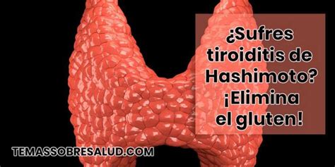 Sufres Tiroiditis De Hashimoto Medidas Para Mejorar