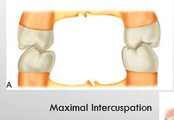 Review Determinants Of Occlusal Morphology Mandibular Movement