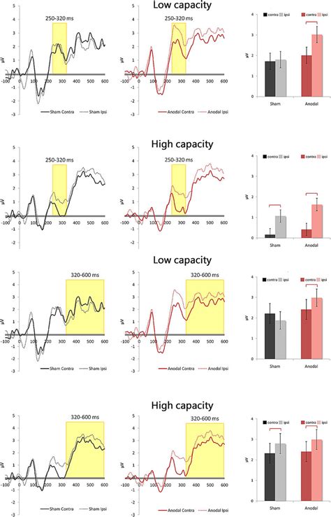 Top Tdcs Increases N2pc Component In Low Performers But Failed To