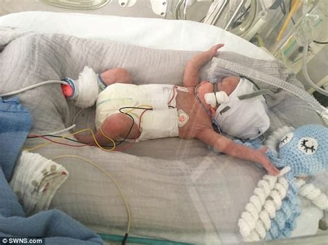 Meet The Miracle Baby Boy Born At 22 Weeks Daily Mail Online