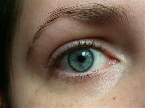 Pin Van Ashleigh M Op Heterochromia Iridum