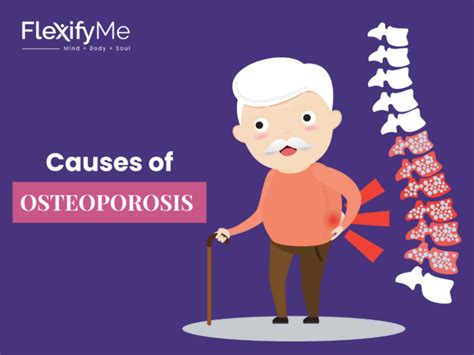 Osteoporosis Causes Symptoms Effective Treatment Options