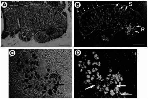 Wt1 Expression In The Testis In The Embryonic Testis Shortly After